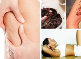 7 sfaturi pentru a preveni celulita